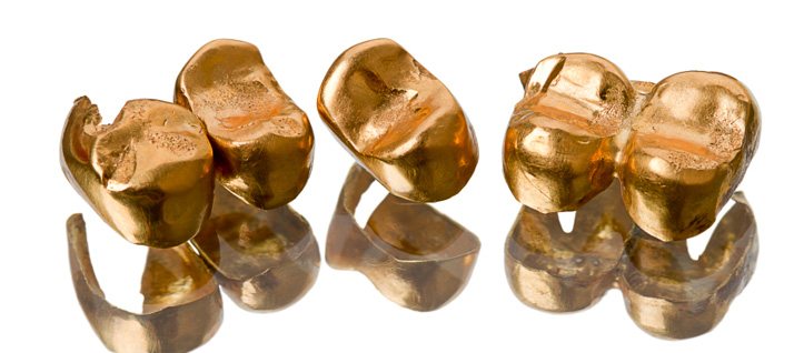 zahngold