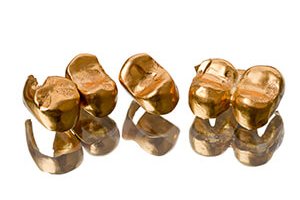 zahngold-ankauf-berlin
